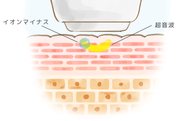 ツインリフトの使用イメージ