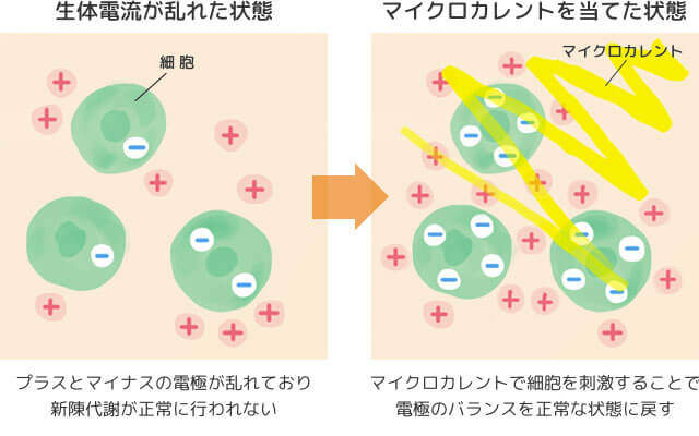 マイクロカレントの仕組みの解説